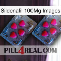 Sildenafil 100Mg Images 14